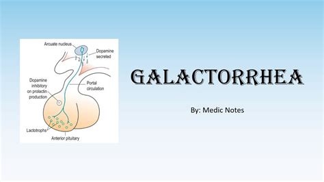 Galactorrhea: Symptoms, Causes in Men and。